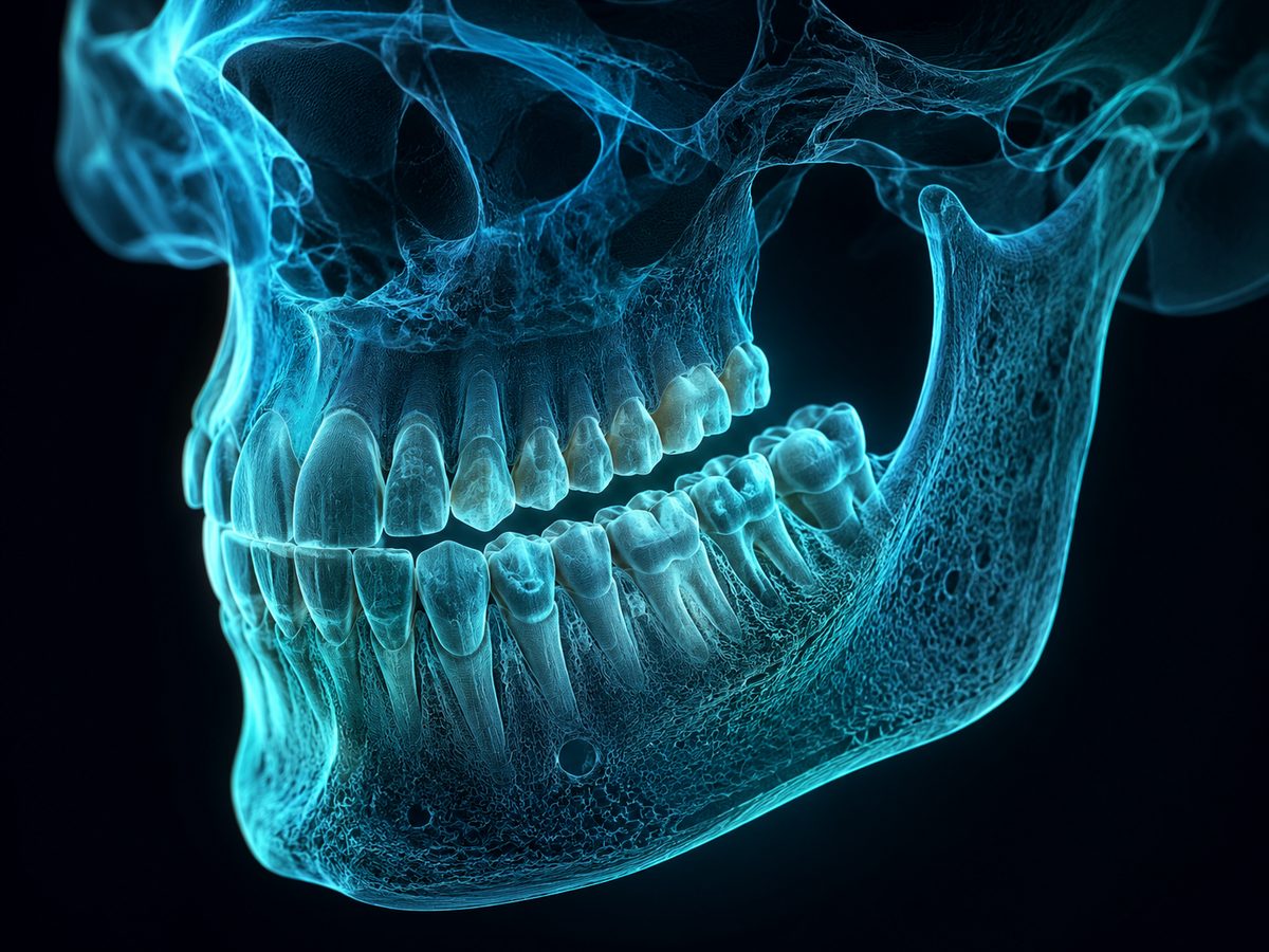 3D CBCT diagnostika